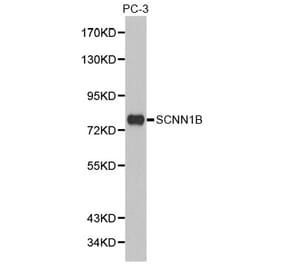 Western blot - SCNN1B antibody from Signalway Antibody (38293) - Antibodies.com