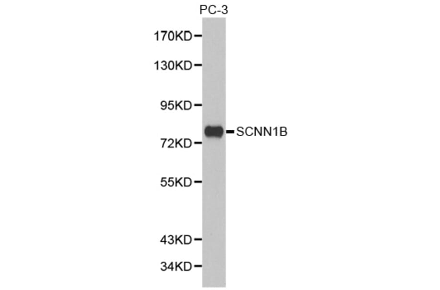 Western blot - SCNN1B antibody from Signalway Antibody (38293) - Antibodies.com