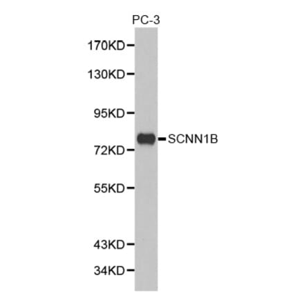 SCNN1B Antibodies