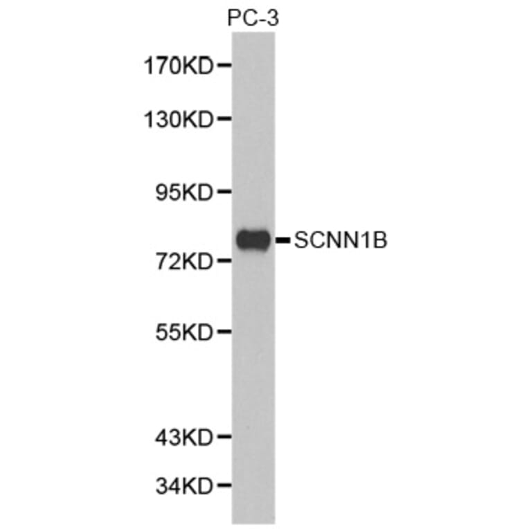 Western blot - SCNN1B antibody from Signalway Antibody (38293) - Antibodies.com