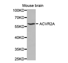 Western blot - ACVR2A antibody from Signalway Antibody (38330) - Antibodies.com