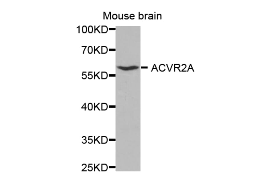 Western blot - ACVR2A antibody from Signalway Antibody (38330) - Antibodies.com