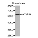 Western blot - ACVR2A antibody from Signalway Antibody (38330) - Antibodies.com