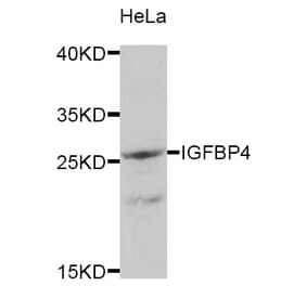 Western blot - IGFBP4 antibody from Signalway Antibody (38333) - Antibodies.com