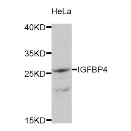 Western blot - IGFBP4 antibody from Signalway Antibody (38333) - Antibodies.com