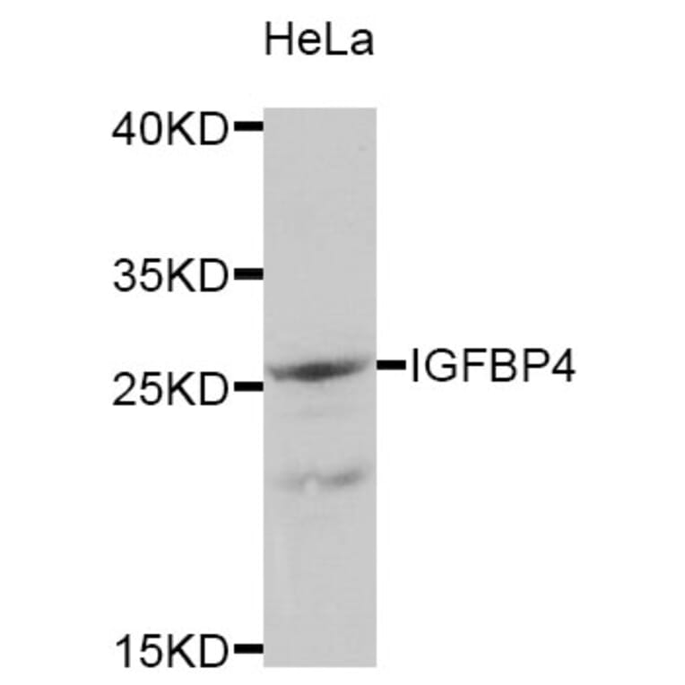 Western blot - IGFBP4 antibody from Signalway Antibody (38333) - Antibodies.com