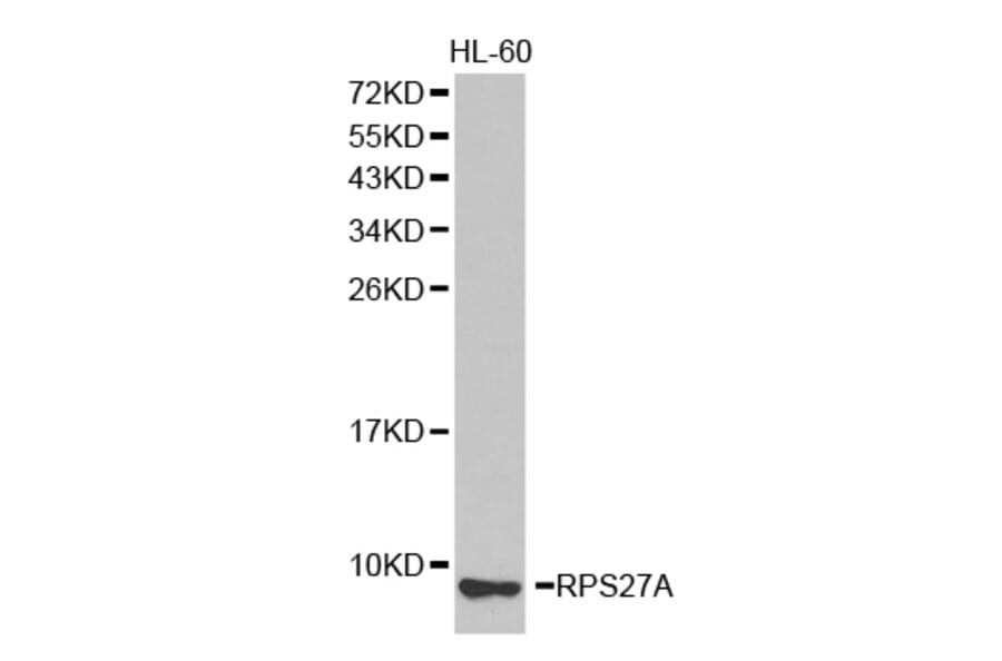 Western blot - RPS27A antibody from Signalway Antibody (38336) - Antibodies.com