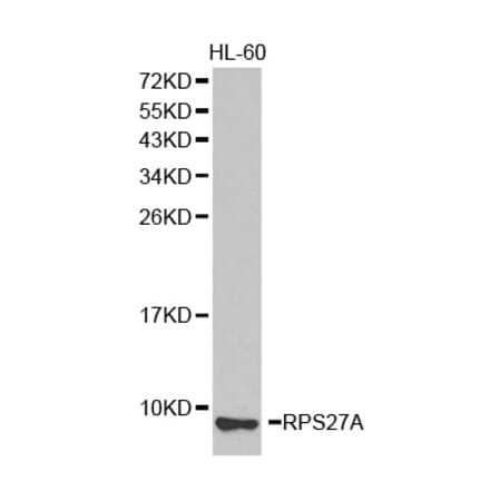 Western blot - RPS27A antibody from Signalway Antibody (38336) - Antibodies.com