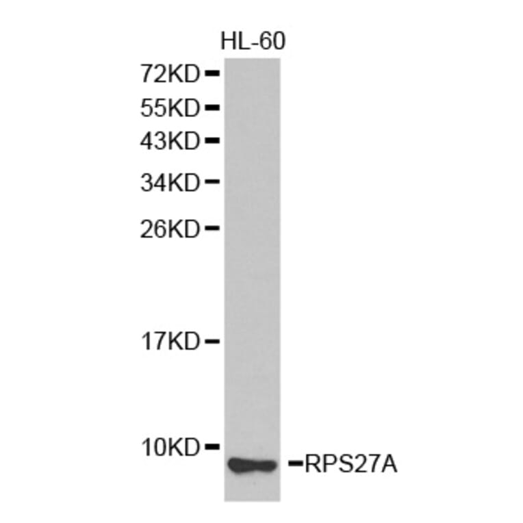 Western blot - RPS27A antibody from Signalway Antibody (38336) - Antibodies.com