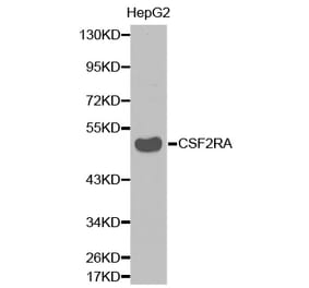 Western blot - CSF2RA antibody from Signalway Antibody (38337) - Antibodies.com