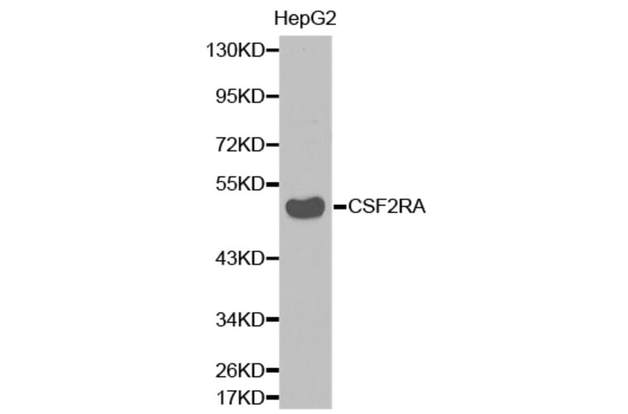 Western blot - CSF2RA antibody from Signalway Antibody (38337) - Antibodies.com