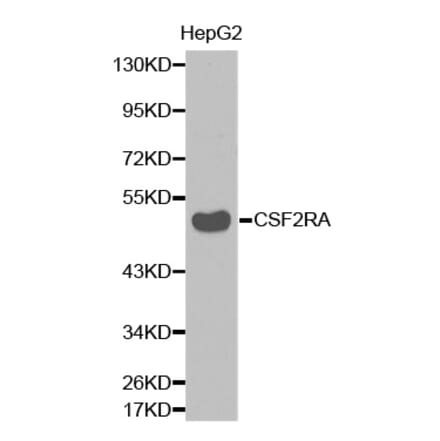 Western blot - CSF2RA antibody from Signalway Antibody (38337) - Antibodies.com