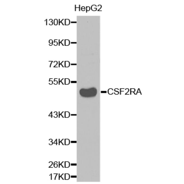 Western blot - CSF2RA antibody from Signalway Antibody (38337) - Antibodies.com