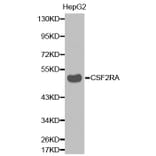 Western blot - CSF2RA antibody from Signalway Antibody (38337) - Antibodies.com
