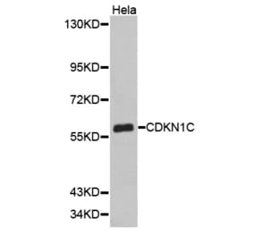 Western blot - CDKN1C antibody from Signalway Antibody (38348) - Antibodies.com