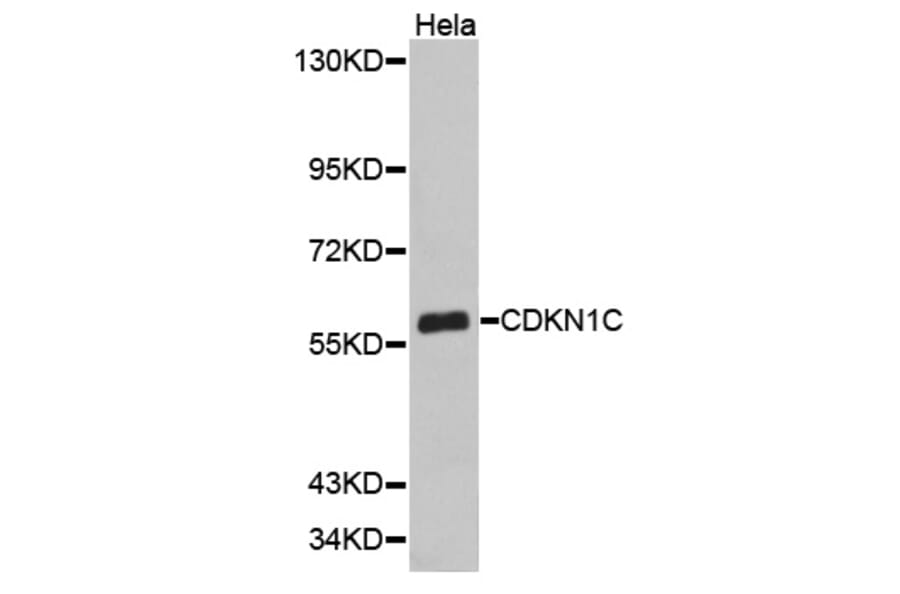 Western blot - CDKN1C antibody from Signalway Antibody (38348) - Antibodies.com