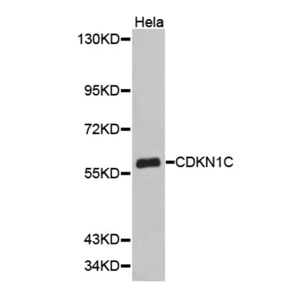 Western blot - CDKN1C antibody from Signalway Antibody (38348) - Antibodies.com
