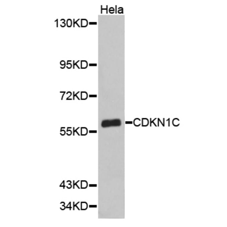 Western blot - CDKN1C antibody from Signalway Antibody (38348) - Antibodies.com