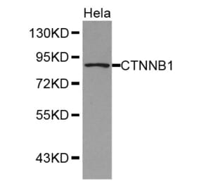 Western blot - CTNNB1 antibody from Signalway Antibody (38350) - Antibodies.com