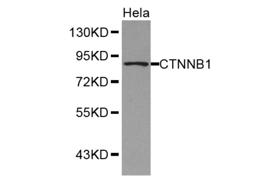 Western blot - CTNNB1 antibody from Signalway Antibody (38350) - Antibodies.com