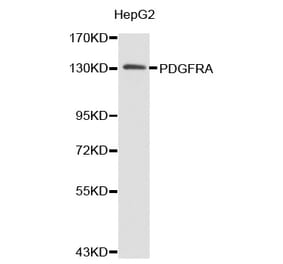 Western blot - PDGFRA antibody from Signalway Antibody (38364) - Antibodies.com