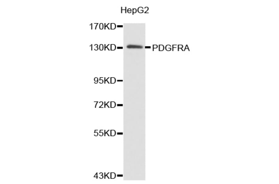 Western blot - PDGFRA antibody from Signalway Antibody (38364) - Antibodies.com