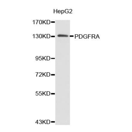 Western blot - PDGFRA antibody from Signalway Antibody (38364) - Antibodies.com