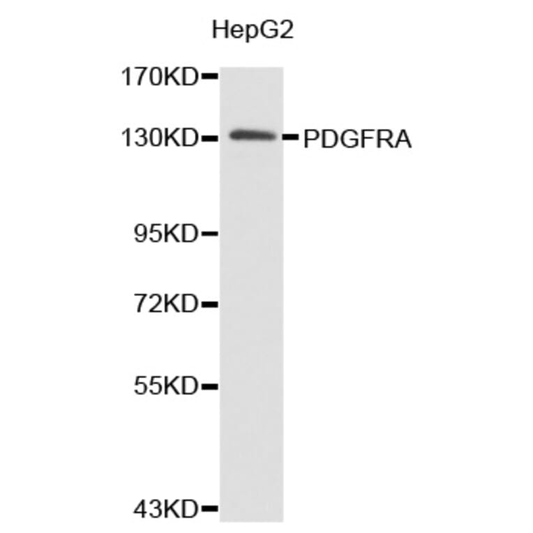 Western blot - PDGFRA antibody from Signalway Antibody (38364) - Antibodies.com