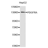 Western blot - PDGFRA antibody from Signalway Antibody (38364) - Antibodies.com