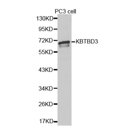 Western blot - KBTBD3 antibody from Signalway Antibody (38384) - Antibodies.com