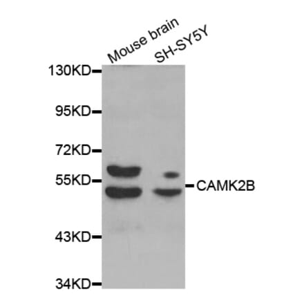 Western blot - CAMK2B antibody from Signalway Antibody (38411) - Antibodies.com
