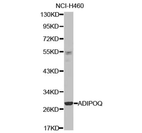 Western blot - ADIPOQ antibody from Signalway Antibody (38421) - Antibodies.com