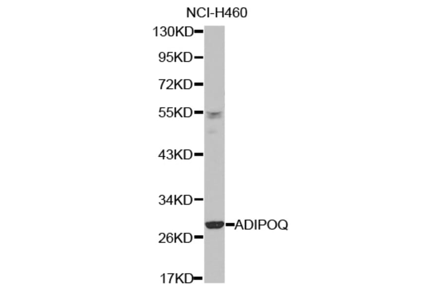 Western blot - ADIPOQ antibody from Signalway Antibody (38421) - Antibodies.com