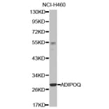 Western blot - ADIPOQ antibody from Signalway Antibody (38421) - Antibodies.com