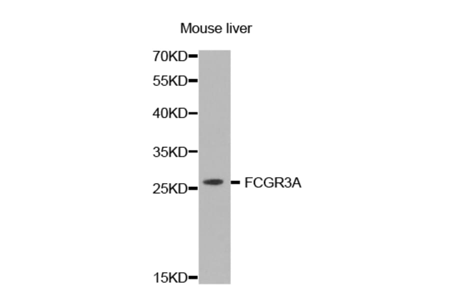 Western blot - FCGR3A antibody from Signalway Antibody (38423) - Antibodies.com