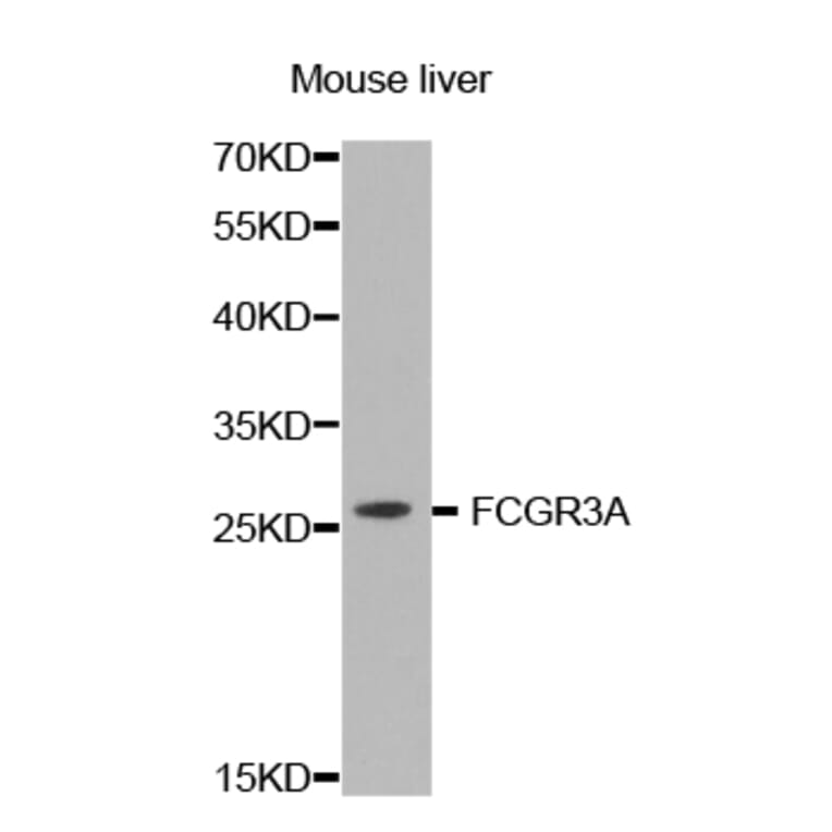 Western blot - FCGR3A antibody from Signalway Antibody (38423) - Antibodies.com