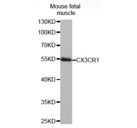 Western blot - CX3CR1 antibody from Signalway Antibody (38481) - Antibodies.com