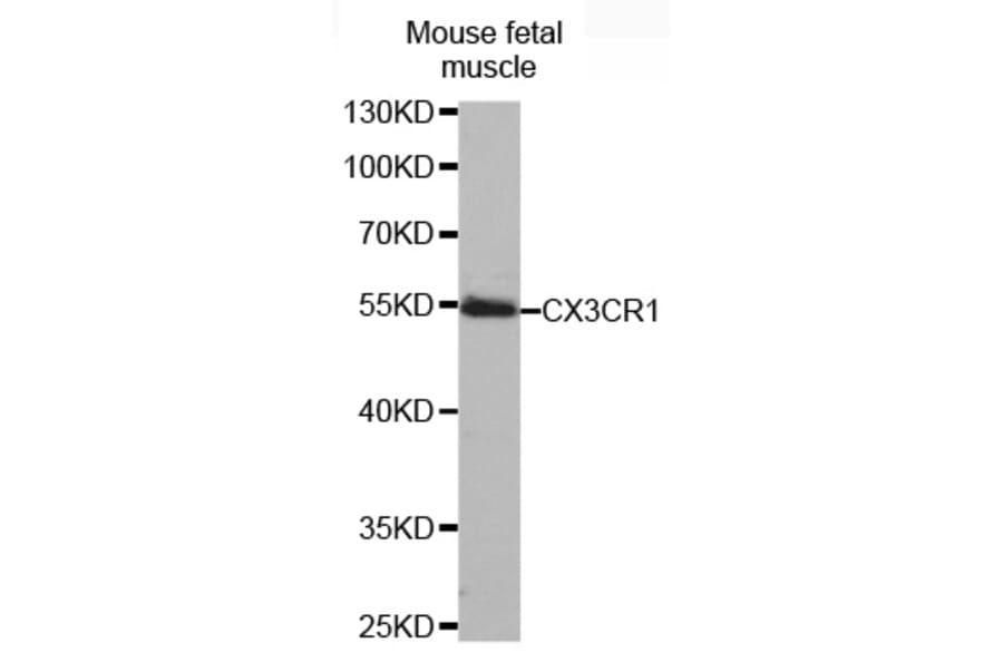 Western blot - CX3CR1 antibody from Signalway Antibody (38481) - Antibodies.com
