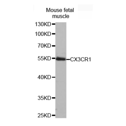 Western blot - CX3CR1 antibody from Signalway Antibody (38481) - Antibodies.com