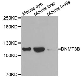 Western blot - DNMT3B antibody from Signalway Antibody (38488) - Antibodies.com