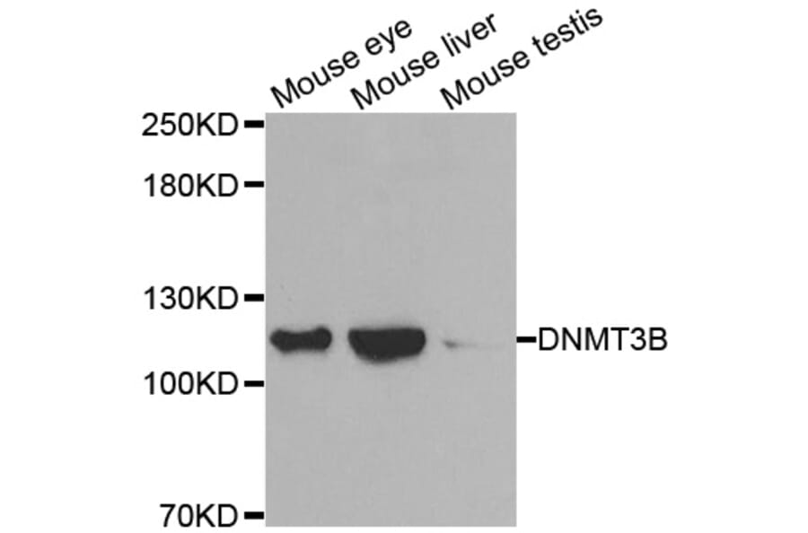 Western blot - DNMT3B antibody from Signalway Antibody (38488) - Antibodies.com