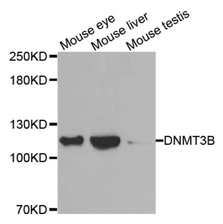 Western blot - DNMT3B antibody from Signalway Antibody (38488) - Antibodies.com
