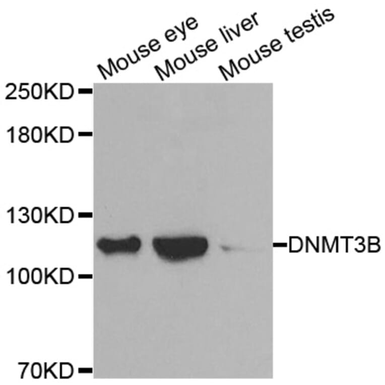 Western blot - DNMT3B antibody from Signalway Antibody (38488) - Antibodies.com