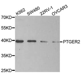 Western blot - PTGER2 antibody from Signalway Antibody (38496) - Antibodies.com