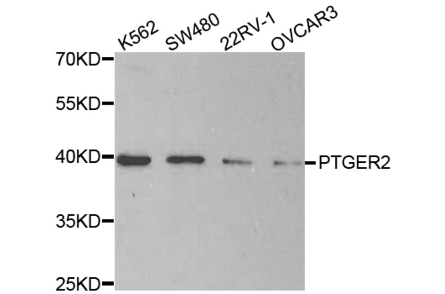 Western blot - PTGER2 antibody from Signalway Antibody (38496) - Antibodies.com