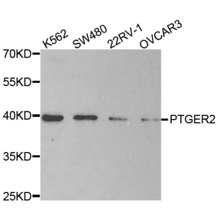 Western blot - PTGER2 antibody from Signalway Antibody (38496) - Antibodies.com
