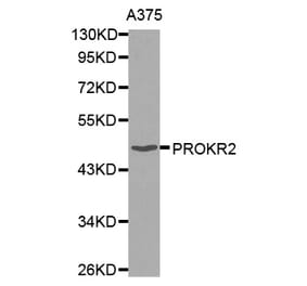 Western blot - PROKR2 antibody from Signalway Antibody (38509) - Antibodies.com