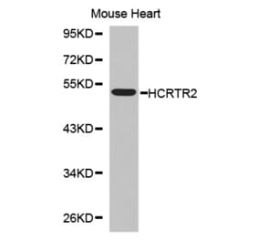 Western blot - HCRTR2 antibody from Signalway Antibody (38555) - Antibodies.com