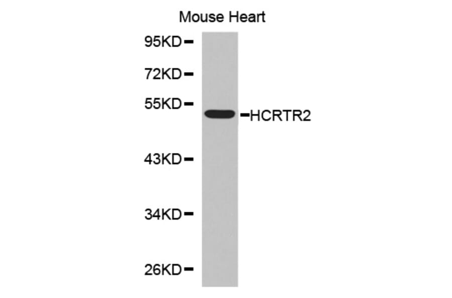 Western blot - HCRTR2 antibody from Signalway Antibody (38555) - Antibodies.com