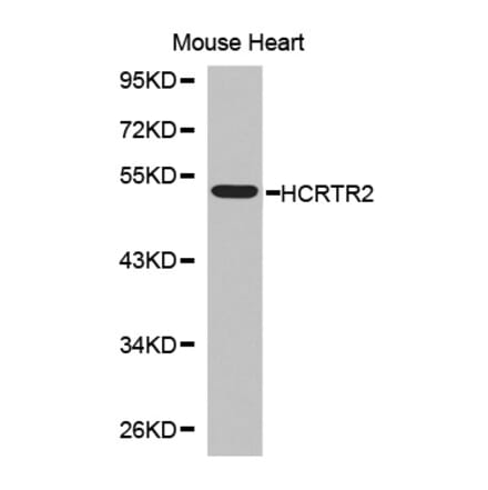 Western blot - HCRTR2 antibody from Signalway Antibody (38555) - Antibodies.com
